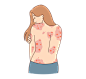 Girl With Skin Rashes Illustration - Free Download People Illustrations |  IconScout