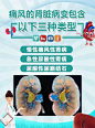 痛风肾脏病变
