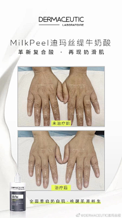 出云之芸采集到果酸