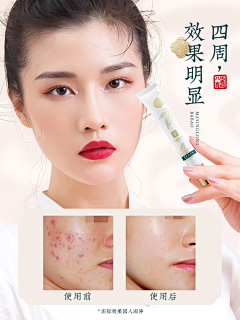 clzlzjx采集到马应龙