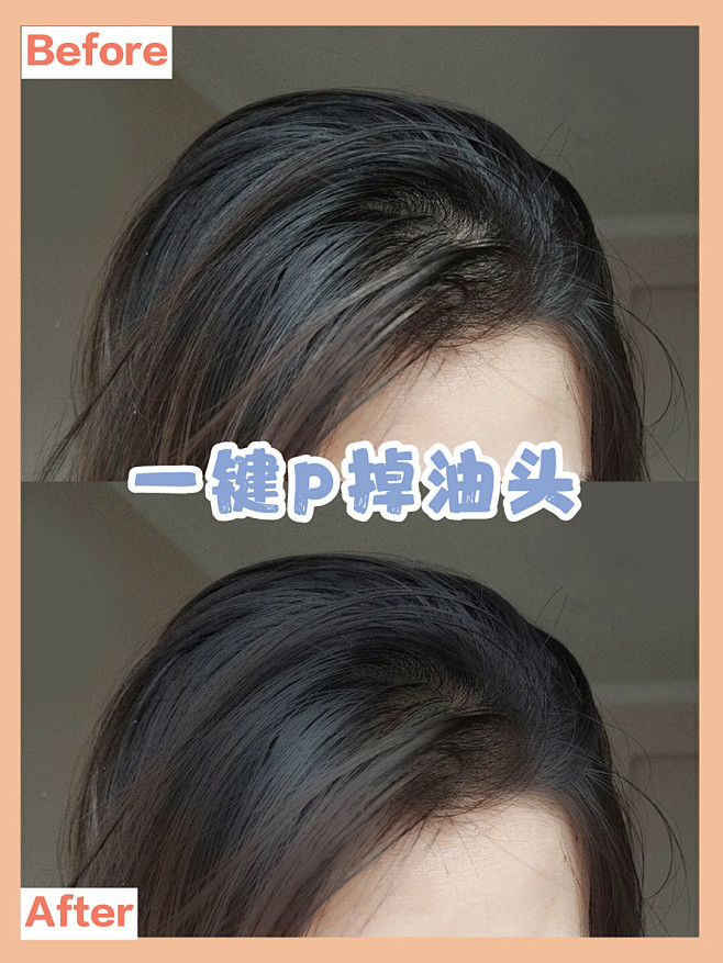 神技能❗️一键P掉油头，头发秒蓬松❗️ ...