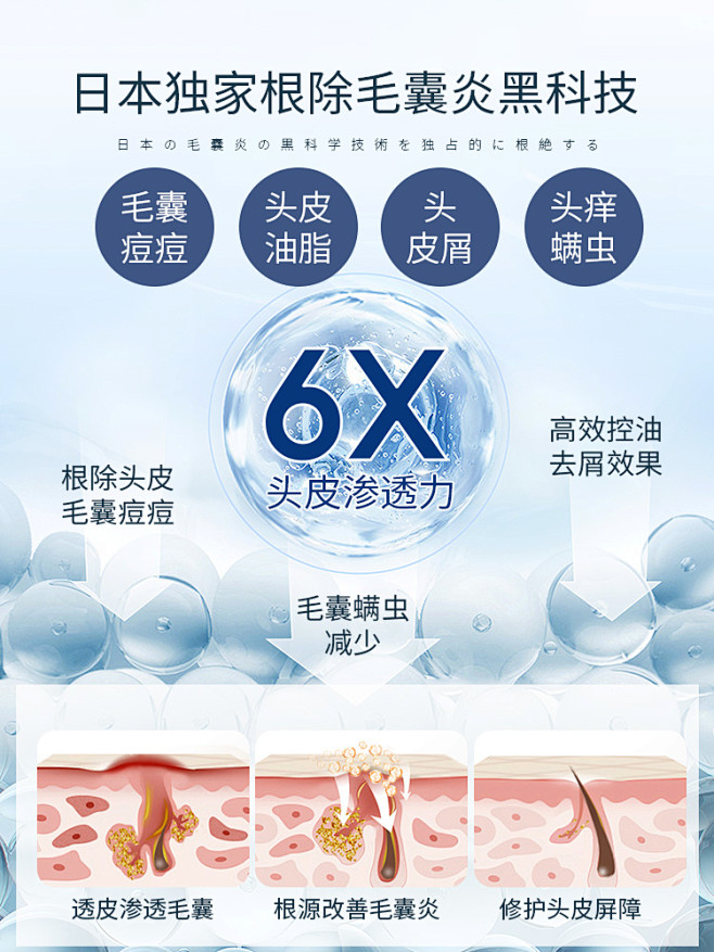 毛囊炎洗发水露氨基酸头皮深层清洁除螨去屑...