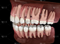 人类下颌和上颌牙龈和牙齿的形态。医学上准确的牙齿3D插图
