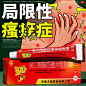 复方醋酸地塞米松乳膏湿疹膏皮炎皮肤过敏止痒药膏皮炎平软膏正品
