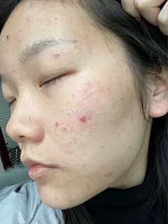 @脸脸变好看 的个人主页 - 微博