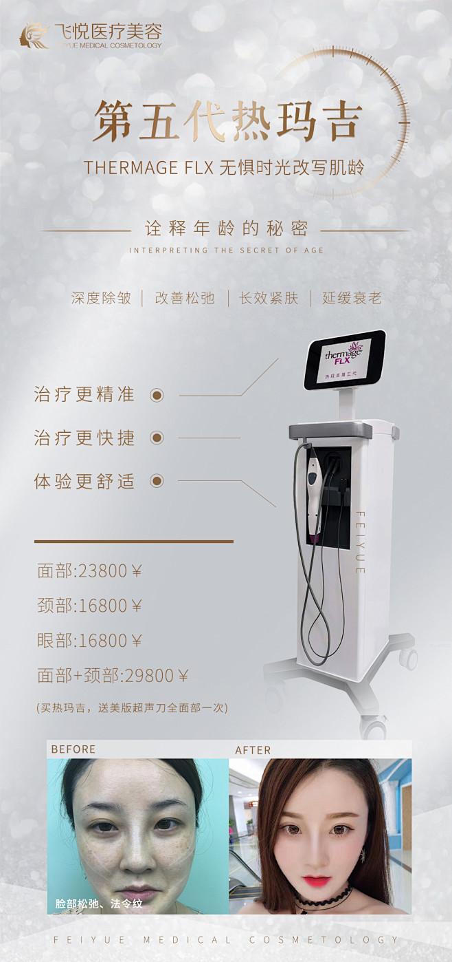 医美热玛吉