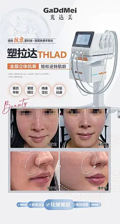 医美整形仪器海报-享设计