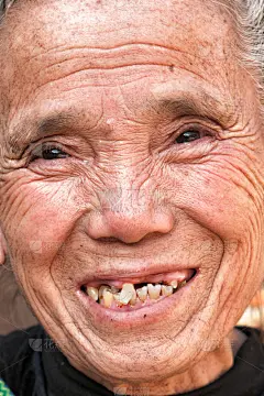 缺牙,牙龈,龋齿,困窘,垂直画幅,人的嘴,机器,齿轮,中国,成年的