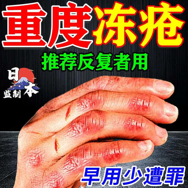 冻疮膏止痒冻伤膏搭配治手裂的药防皲裂特效防冻消肿开干燥足耳朵-tmall.com天猫图片_待归类采集图片素材-花瓣网