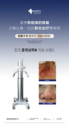 ai等离子术