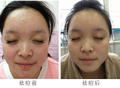 长耳朵兔兔采集到案例