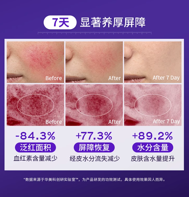 修复面霜保湿滋润补水修复肌肤屏障受损修护...