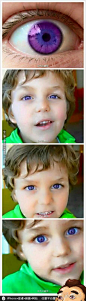 【关注@韩禹杰】紫色的虹膜--全球只有600双这样的眼睛，概率一千万分之一。