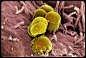 显微镜下的淋病奈瑟菌。