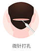 植发流程过程---微针打孔