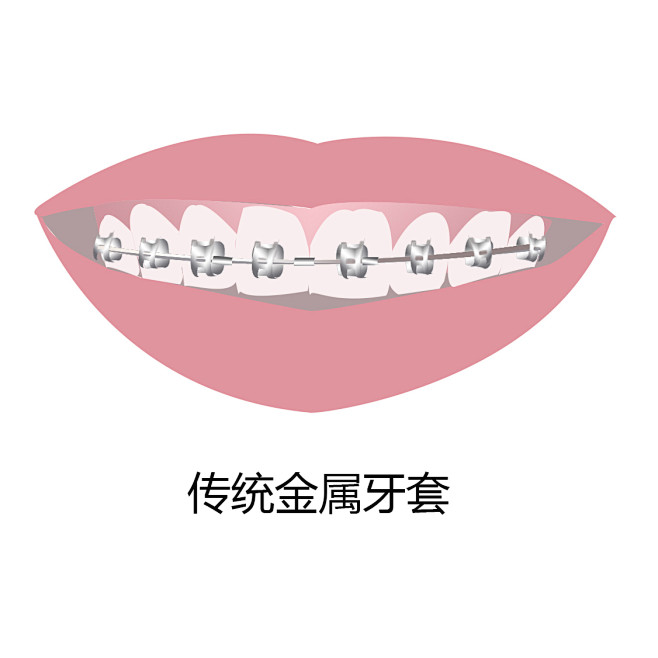 牙齿 口腔 漫画 插画 卡通 牙齿矫正 牙齿疾病 牙齿稀疏 牙齿错乱 反颌 牙列拥挤 中线不齐 开颌 牙齿缺损 深覆合 龅牙 牙齿不齐 偏颌 
