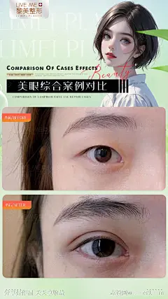 眼综合案例简约海报-源文件-志设网-zs9.com