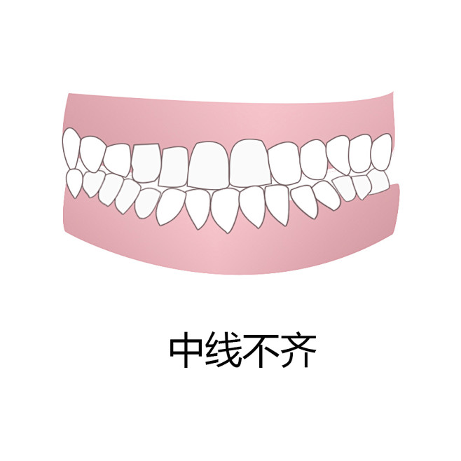 牙齿 口腔 漫画 插画 卡通 牙齿矫正 牙齿疾病 牙齿稀疏 牙齿错乱 反颌 牙列拥挤 中线不齐 开颌 牙齿缺损 深覆合 龅牙 牙齿不齐 偏颌 