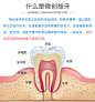 杭州瑞创口腔成人微创拔牙牙齿拔除治疗智齿阻生牙齿科牙科智齿-tmall.com天猫