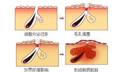 小米的心情谁能理解采集到化妆品素材