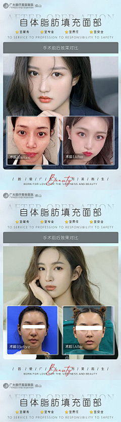 娜DADA采集到案例对比