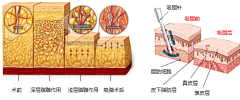 ZHANG·Y采集到皮肤层次