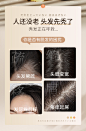 生姜洗发水防脱发固育发控油蓬松去屑止痒洗头膏露官方正品男女生-tmall.com天猫