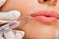 Close up of having beauty treatment with Botox.