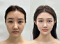 #每秒都值得记录 #轮廓固定 #面部提升 #骨韧双修 #医美 #变美我熟 #变美小技巧 #提升 #笔记灵感 #更好的自己 - 小红书