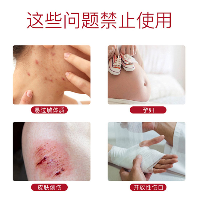 滑膜炎贴膝盖关节积液积水膏药疼痛专用冷敷...