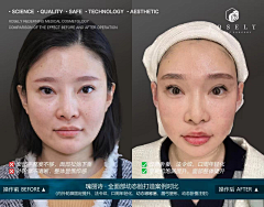 霏girl采集到案例水印