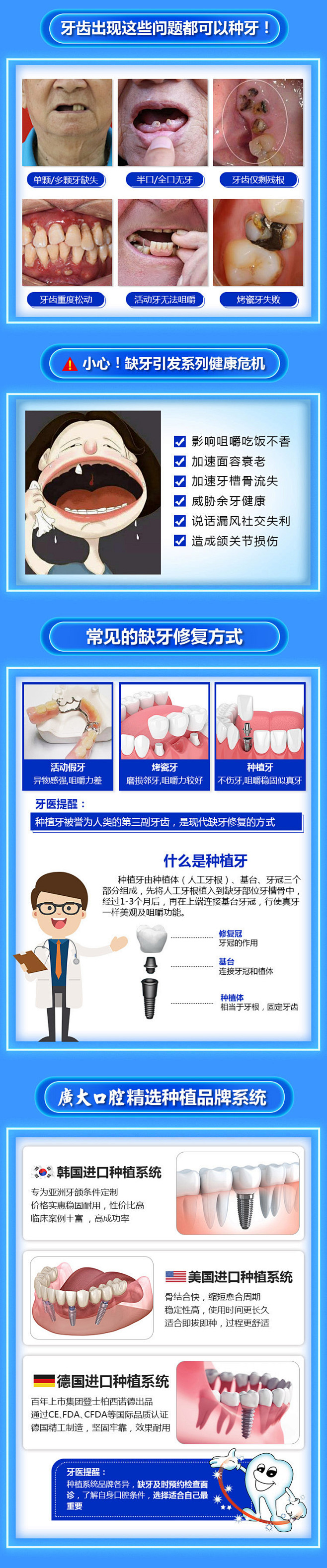 广州广大口腔登腾种植牙种植体牙冠基台种植...