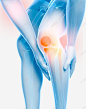 膝盖关节炎医疗插图 平面电商 创意素材