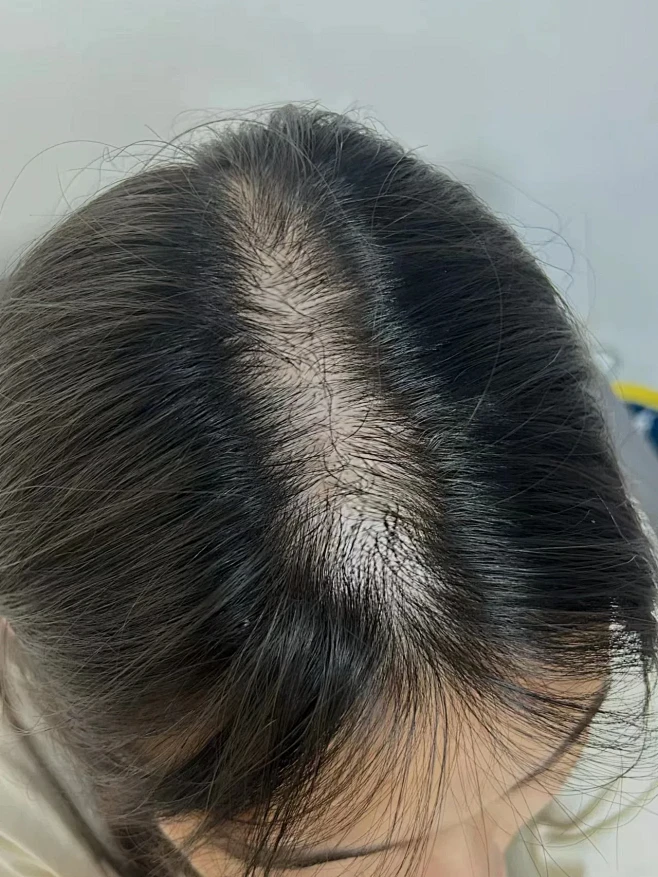 都去给我买！！！！！！！！（重度秃头）-花瓣网