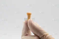 牙医手拿医用手套检查扭断的智齿。口腔护理和清洁牙齿的概念。