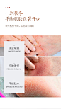 脚后跟干裂修复霜马油防干裂龟裂口护手足防裂皲裂蛇油愈合冻疮膏-tmall.com天猫