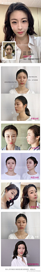 上海华美医疗美容医院的照片 - 微相册