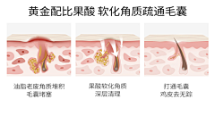 孤傲的粒米采集到问题肌肤结构