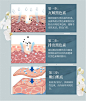 无创溶斑术微晶导入仪器祛斑淡化色斑去黄褐斑雀斑晒斑溶斑液套盒-淘宝网