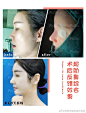  整形外科
————————❤
ܼ所有的美都​是
“蓄​谋已久”
天​生丽质​
是说给未满​16岁​小女​孩听的
一个鼻子撑起整张脸...展开全文c