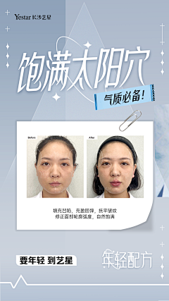 宸垚采集到微整