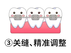 牙齿矫正爱情故事-精准调整（前置）