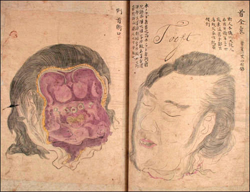 日本江户时代的人体解刨图