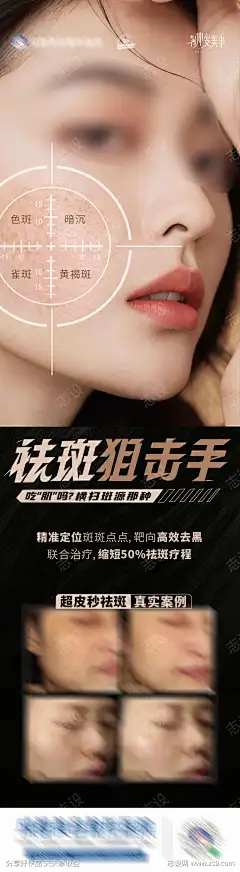 医美美业祛斑狙击手案例创意海报-素材库-sucai1.cn