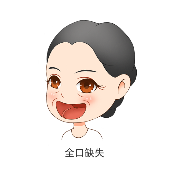 牙齿缺失人物（女）-全口牙缺失