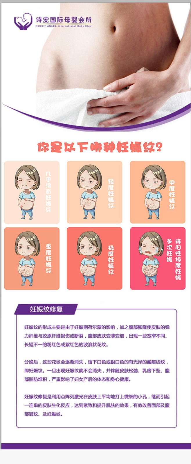 妊娠纹 妊娠纹等级 妊娠纹信息流 妊娠纹...