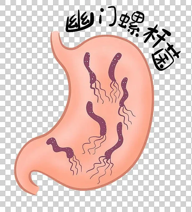 胃里的幽门螺杆菌图片下载