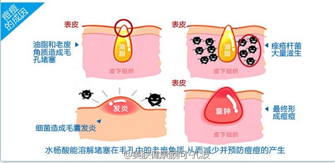 美肤健康顾问-孔波7大毁容化妆品成分：1...