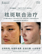医美效果图对比图前后术后案例效果整形微整医疗美容