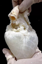 一个干净的心脏，已经洗去所有供体血液细胞，只留下蛋白质支架，等待进行移植。